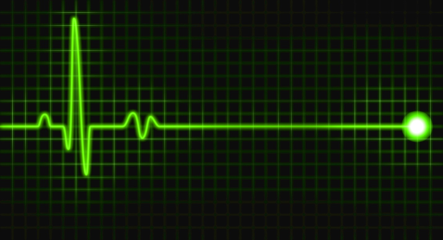 A green line on a black background

AI-generated content may be incorrect.